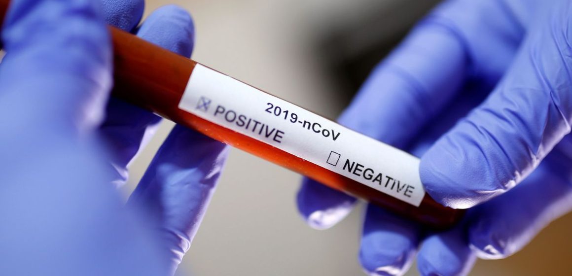 Estudo aponta que Covid-19 causa distúrbios neurológicos em pessoas com sintomas leves