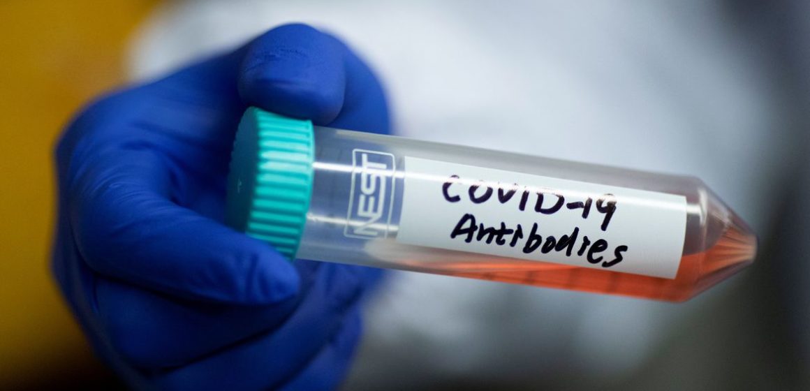 2020-04-01t132400z_1_lynxmpeg30405_rtroptp_4_health-coronavirus-china-scientists Campo Grande atinge bandeira cinza e vai ter de fechar
