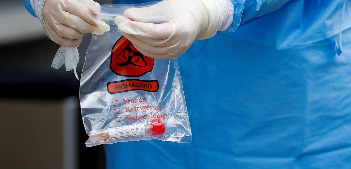 OMS pede colaboração para investigar origens do novo coronavírus