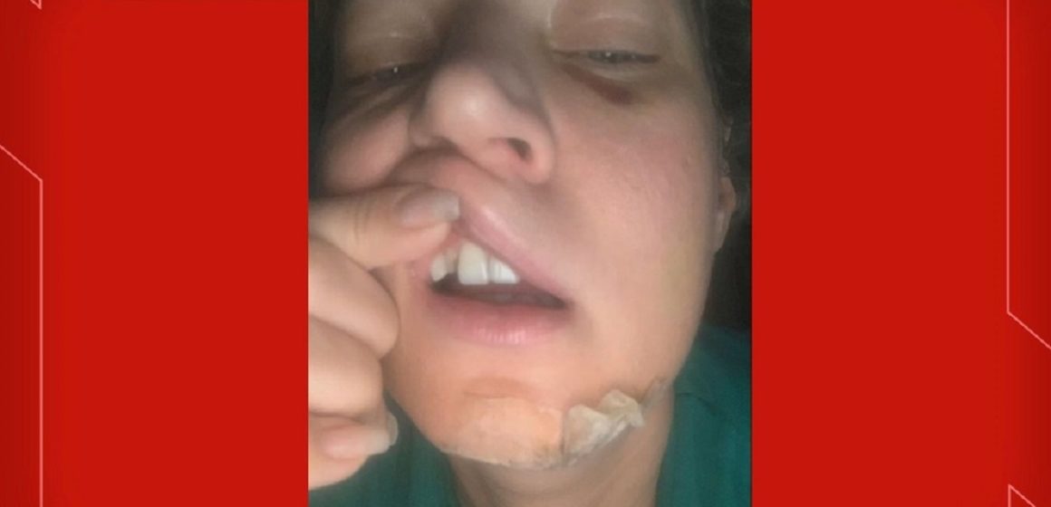 Joice Hasselmann: polícia do DF descarta agressão e diz que deputada caiu ‘da própria altura’