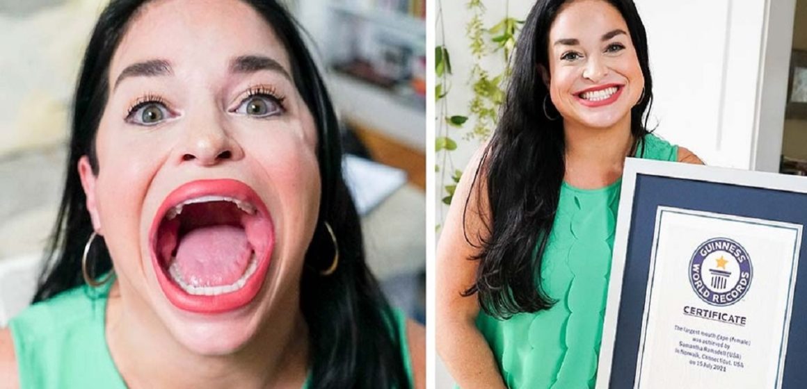 Americana bate recorde com a maior boca do mundo