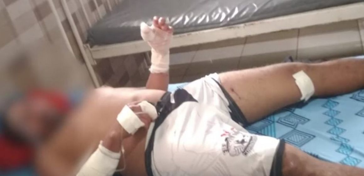 Em Soure, homem atacado por Pitbull mata animal ao se defender