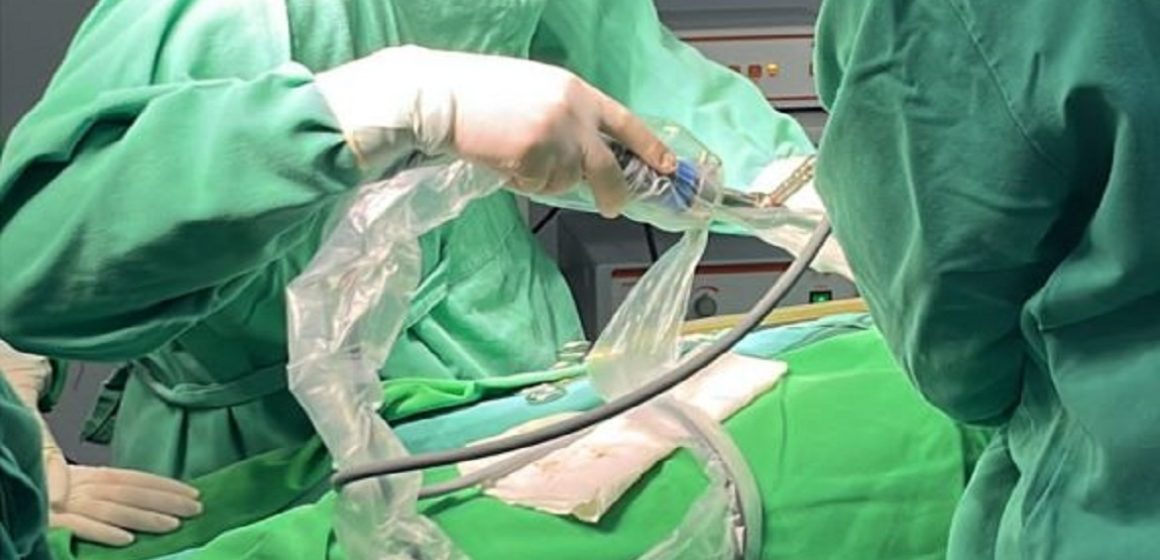 Primeira cirurgia de vesícula por vídeo é realizada em Canaã dos Carajás
