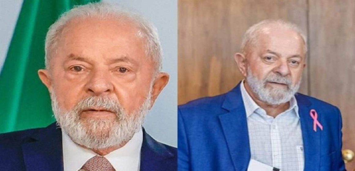 Confira como ficou o presidente Lula após cirurgia plástica nas pálpebras