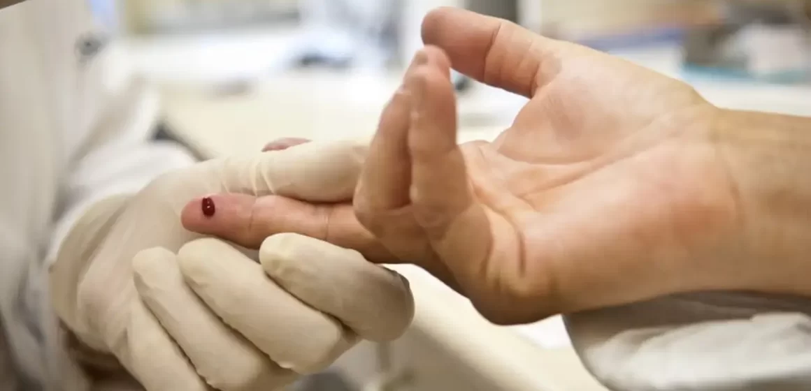 Casos de sífilis e de HIV/aids aumentam entre homens jovens
