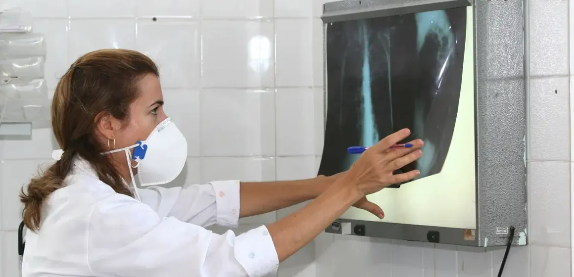 Pará registra mais de mil casos de tuberculose em 107 dias deste ano