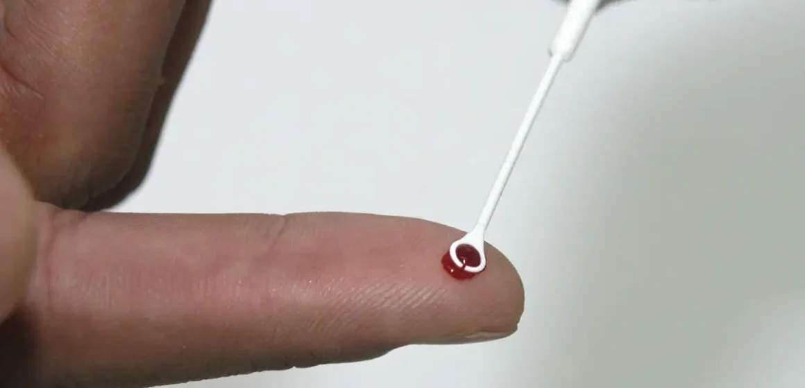 Estudo aponta que nova variante do HIV circula em 3 estados do Brasil