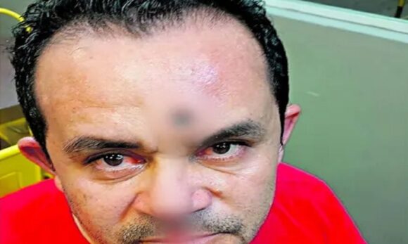 Em Santa Luzia do Pará, homem sobrevive após ser baleado na testa