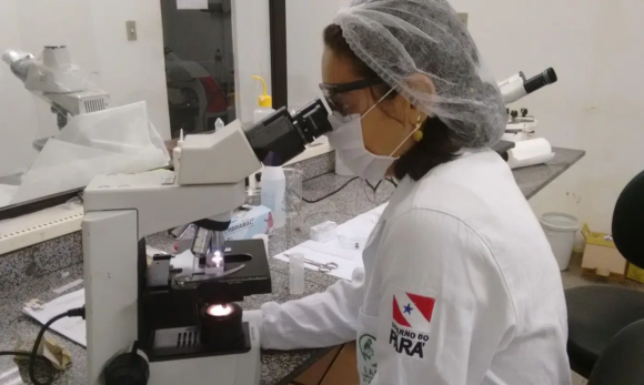 20250210194557-GC00064445-F00222905E Pará registra redução nos casos de doença de Chagas em 2024