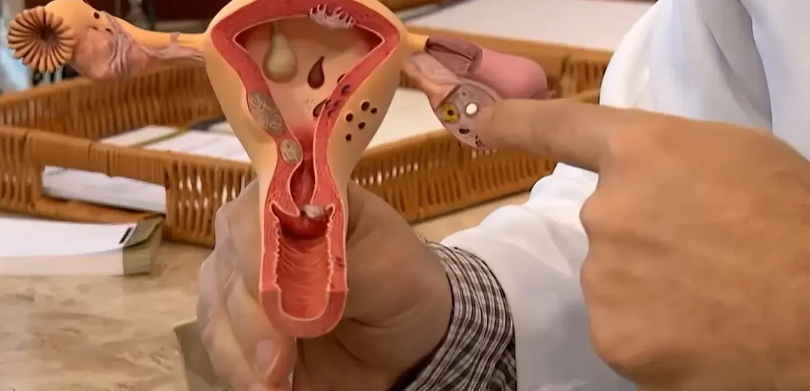 verdeescuro_1 Endometriose: conheça os sintomas e saiba como tratar a doença