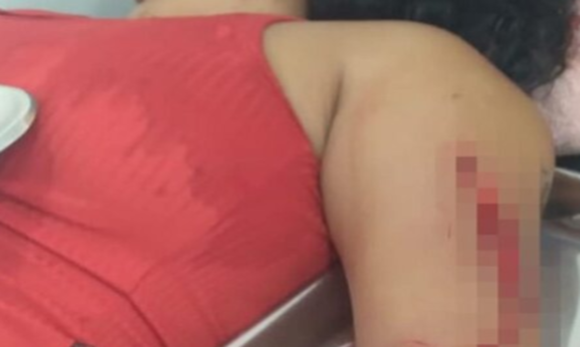 Jovem leva facadas em Itaituba enquanto dormia em garimpo