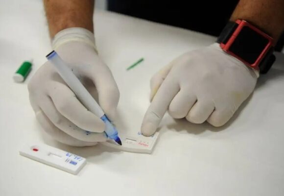 Sespa intensifica ações de prevenção contra hepatites virais no Pará