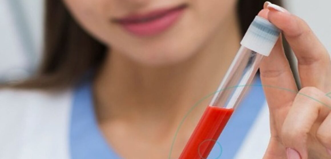 Hemograma: exame essencial para o diagnóstico de doenças