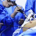 SUS realiza apenas 10% das cirurgias bariátricas no Brasil, mesmo com CFM ampliando critérios
