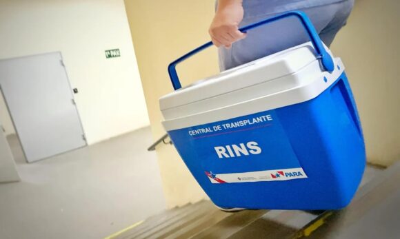 Hospital Abelardo Santos consolida rede de transplantes no Pará com 8 captações em 20 dias