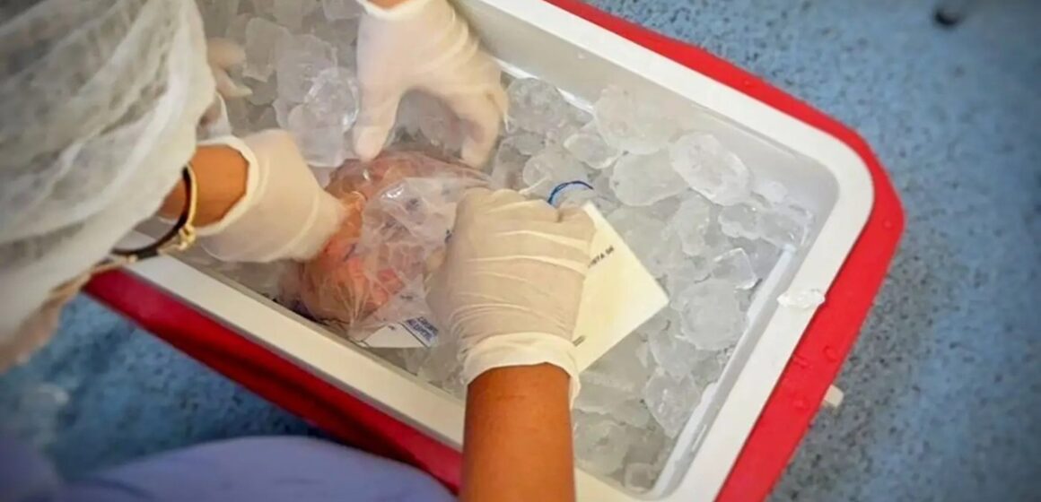 Brasil bate recorde em transplantes, mas enfrenta queda de doadores e fila de espera de 78 mil