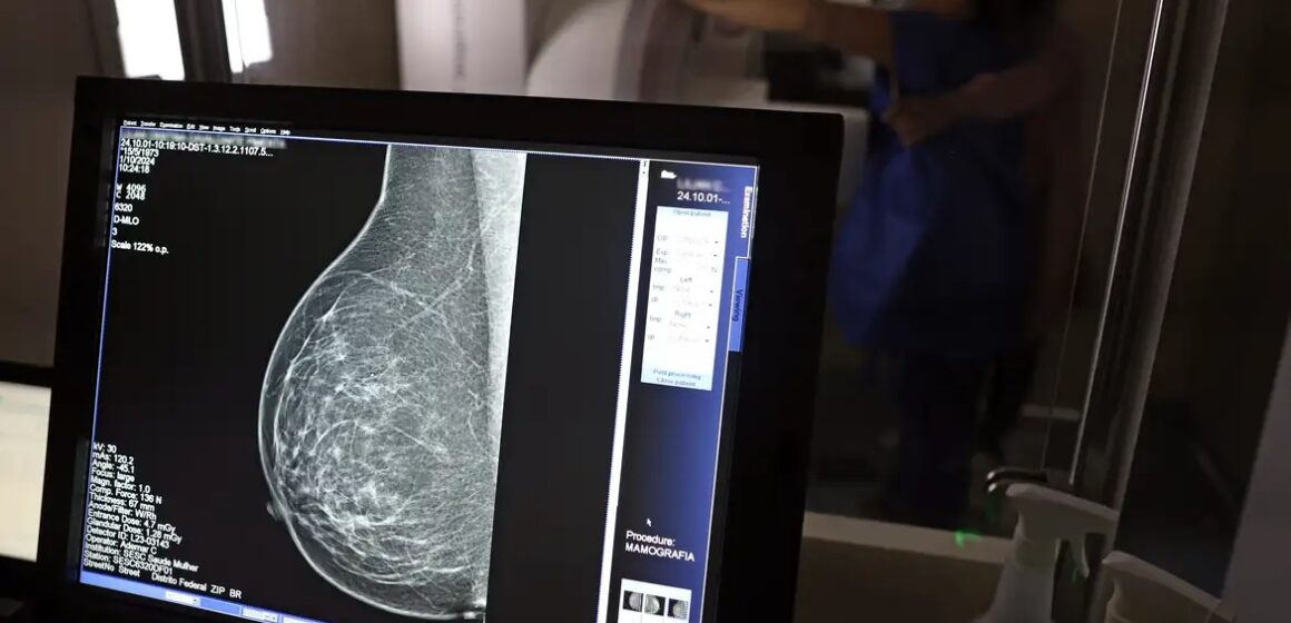 Câncer de mama atinge uma em cada três mulheres abaixo dos 50 anos no Brasil