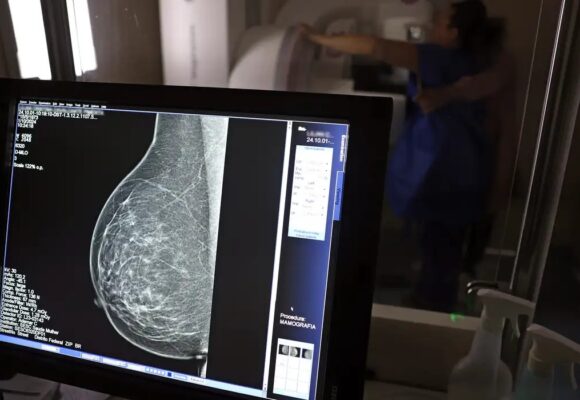 Câncer de mama atinge uma em cada três mulheres abaixo dos 50 anos no Brasil