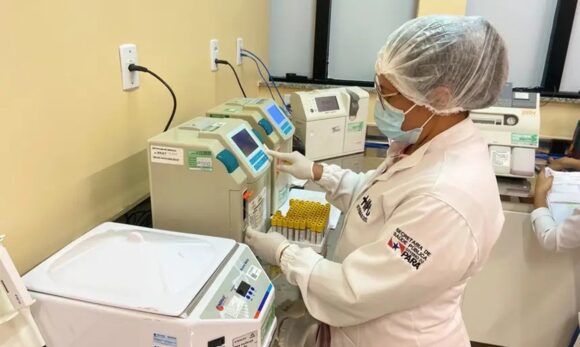 Hospital Regional dos Caetés realiza 161 mil exames em 5 meses e reforça atendimento no nordeste paraense