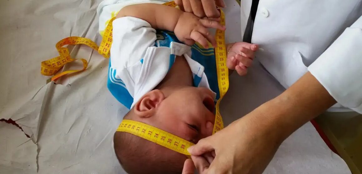 Congresso derruba veto e garante pensão vitalícia para vítimas da zika