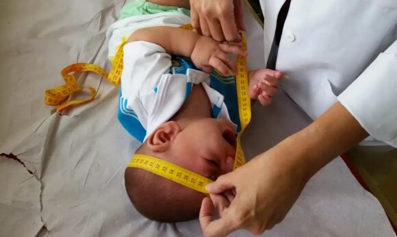 Congresso derruba veto e garante pensão vitalícia para vítimas da zika