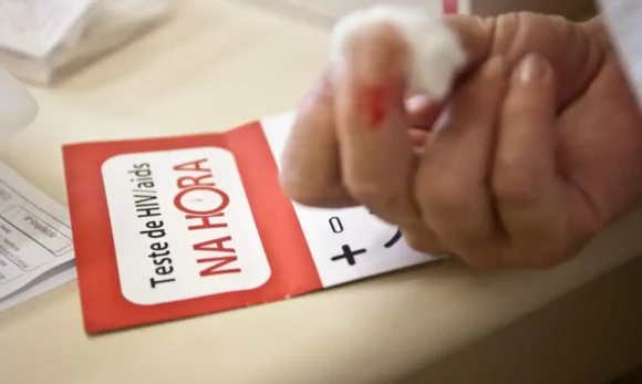 Cientistas australianos criam método capaz de eliminar vírus HIV