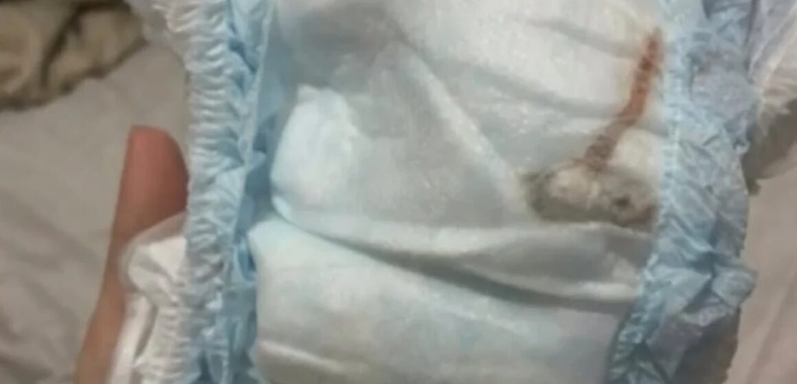 No Rio de Janeiro, mãe descobre rato morto em fralda de bebê recém-nascido