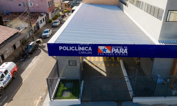 WhatsApp Image 2025-07-14 at 13.25.41 Policlínica Carajás atende mais de 22 mil pacientes em três meses e se consolida como referência no sudeste do Pará