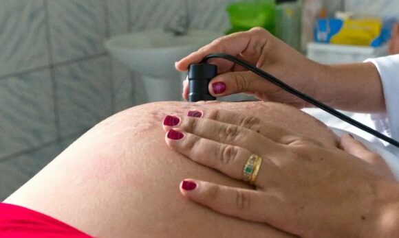 WhatsApp Image 2025-07-22 at 16.30.49 Pré-natal reduz em 47% risco de anomalias congênitas em bebês, aponta estudo da Fiocruz