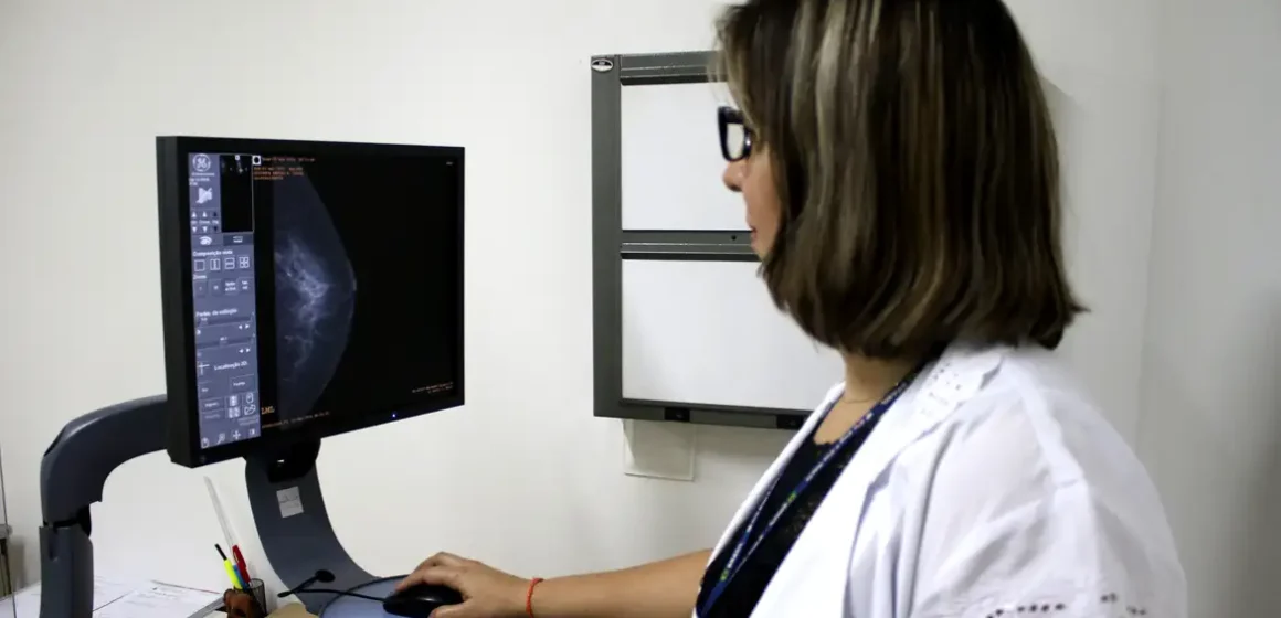 Ministério da Saúde amplia acesso à mamografia a partir dos 40 anos