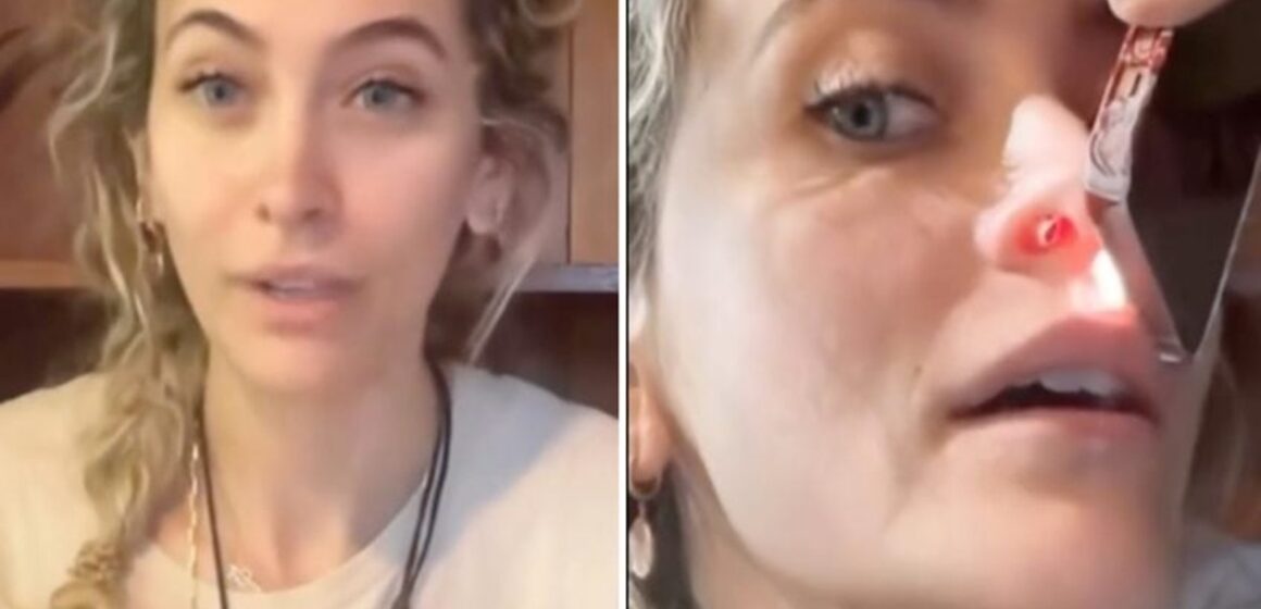 Paris Jackson revela perfuração no septo nasal como sequela do uso de drogas