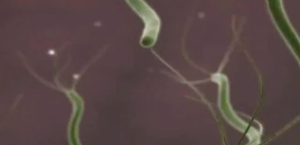 Infecção por H. pylori, bactéria comum no estômago, pode levar a úlceras e gastrite