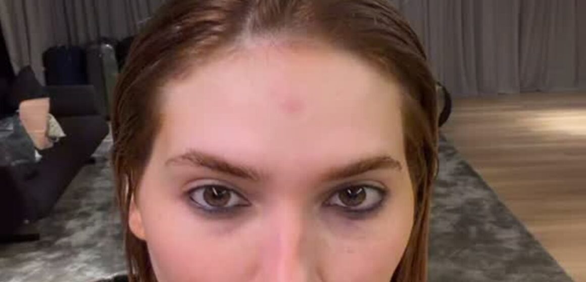 Virginia Fonseca se machuca com fantasia durante ensaio da Grande Rio