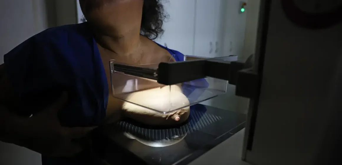 0d9a1809 ANS propõe ampliar cobertura de mamografia digital para todas as idades e gêneros com indicação médica