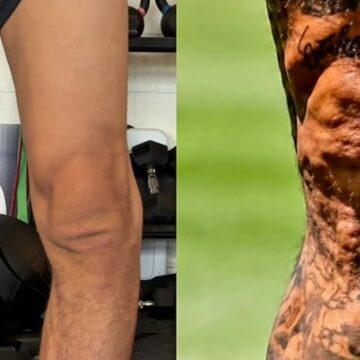 Lutador brasileiro compara joelho ao de Neymar e faz brincadeira nas redes sociais
