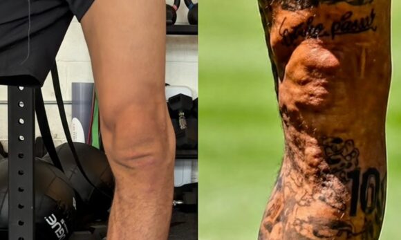 Lutador brasileiro compara joelho ao de Neymar e faz brincadeira nas redes sociais