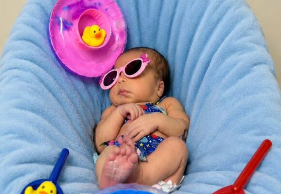 Bebês da UTI Neonatal ganham ensaio temático de verão em Barcarena