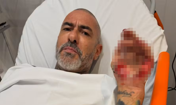 Henrique Fogaça relata acidente de moto, mostra ferimentos e denuncia roubo de aliança em hospital