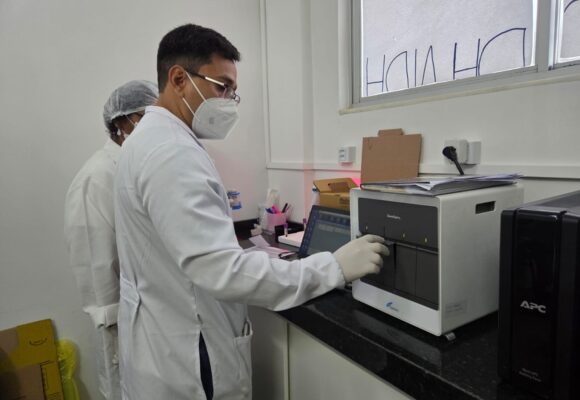 5ecad1c3-71cc-421e-9c52-b977f2c906e7 Casa Dia em Belém realiza 1 mil exames com tecnologia GeneXpert, reduzindo tempo de diagnóstico de HIV para 90 minutos