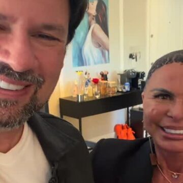 Gretchen revela decisão de raspar a cabeça para realizar transplante capilar