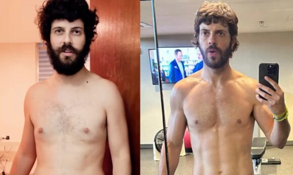 Diogo Defante mostra transformação no corpo após tratamento para retirada de tumor