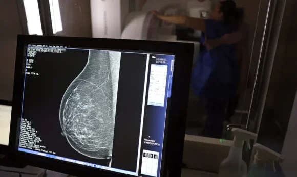 Plano de saúde terá que cobrir mamografia digital para todas as idades